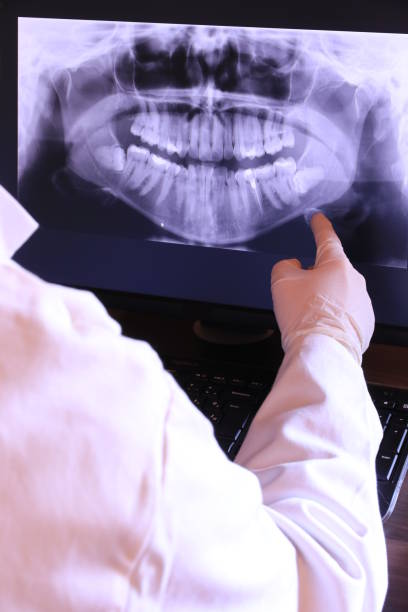 Best Emergency Treatment for Dental Infections or Abscesses in Brookville, PA