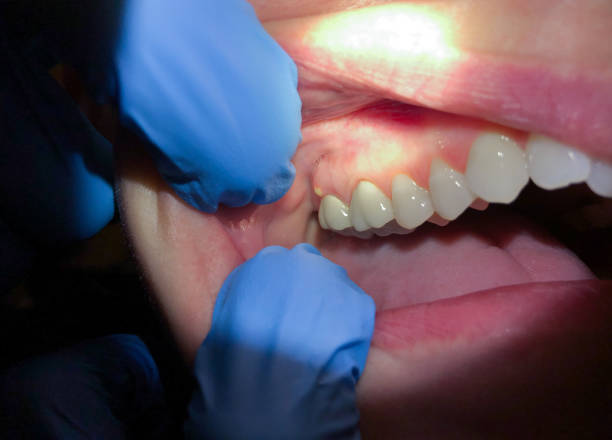 Best Cosmetic Emergency Dentistry in Brookville, PA