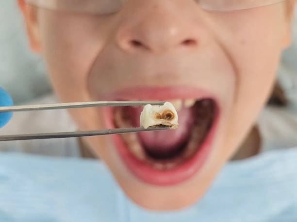 Best Pediatric Emergency Dentist in Brookville, PA