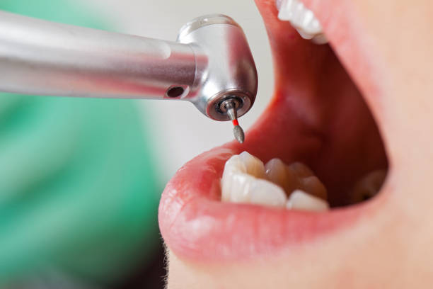 Best Emergency Denture Repair in Brookville, PA